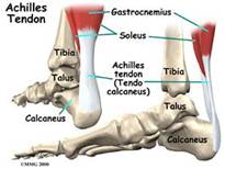 http://www.chirurgenoperatie.nl/pagina/traumatologie/foto/anatomie_achillespees.jpg